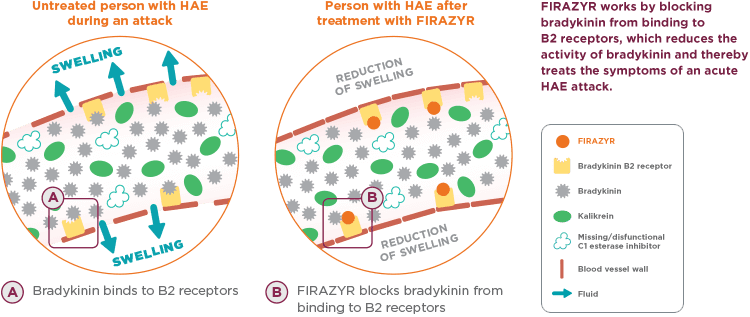 Comparison of an untreated person during an HAE attack vs after treatment with FIRAZYR®. FIRAZYR® blocks bradykinin from binding to B2 receptors, which treats the symptoms of an acute HAE attack.
